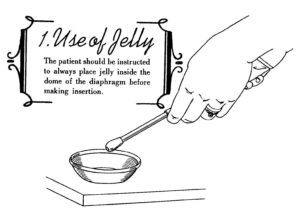Sketch of a woman’s hand, with prominent engagement and wedding rings, demonstrating how to apply spermicidal jelly to a diaphragm. LeMon Clark, The Vaginal Diaphragm (St. Louis: C. V. Mosby, 1939), p. 17. Courtesy of the Kinsey Institute.