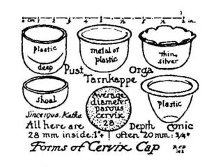 Robert L. Dickinson’s drawing of different types of cervical caps. Ernst Grafenberg and Robert L. Dickinson, “Conception Control by Plastic Cervix Cap,” Western Journal of Surgery, Obstetrics, and Gynecology 52 (August 1944): 339.